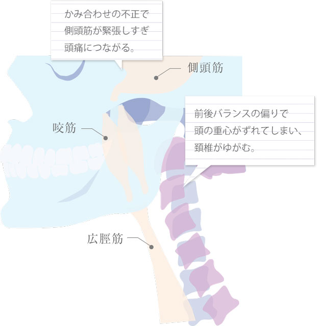 頭痛と歯並び かみ合わせの関係はありますか 池袋駅前歯科 矯正歯科