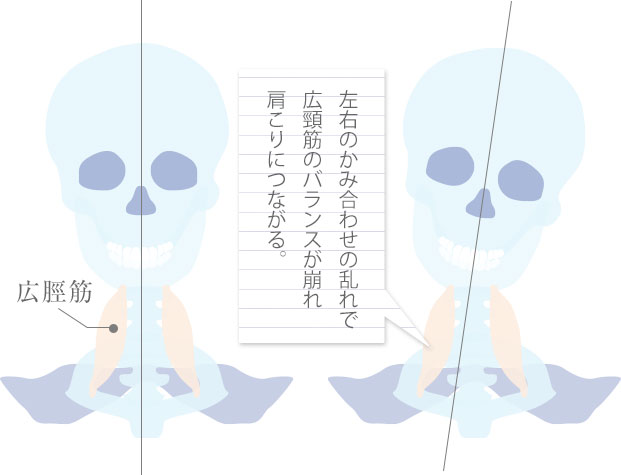 頭痛と歯並び かみ合わせの関係はありますか 池袋駅前歯科 矯正歯科