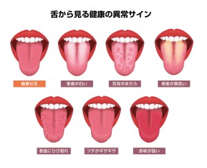 舌診　ワイヤー矯正　歯列矯正