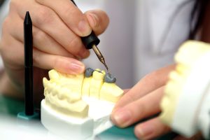 歯科技工士　矯正　池袋