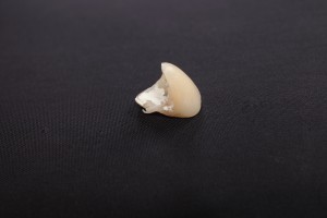 矯正歯科　歯列矯正　歯並び　裏側矯正　ワイヤー矯正　マウスピース矯正　仮歯