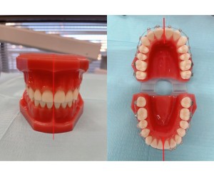 歯の中心　歯　