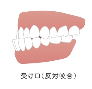 矯正歯科　歯列矯正　歯並び　ワイヤー矯正　