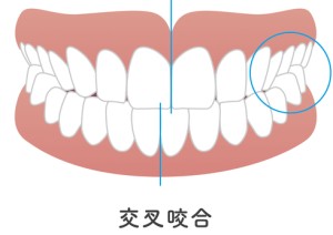 矯正歯科　歯列矯正　歯並び　ワイヤー矯正　