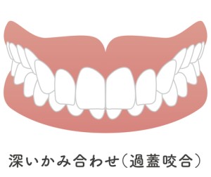 矯正歯科　歯列矯正　歯並び　ワイヤー矯正　