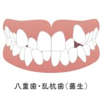 池袋　歯列矯正　歯並び　ワイヤー矯正　矯正歯科