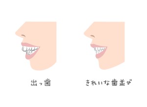 出っ歯の横顔