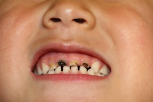 矯正　歯列矯正　歯並び　
出っ歯　矯正歯科
