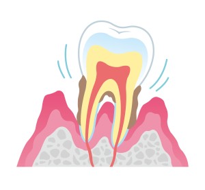 池袋　矯正　歯並び　歯列矯正　矯正歯科　出っ歯