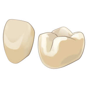 矯正歯科　虫歯　被せ物