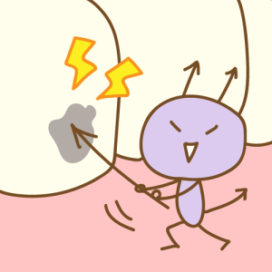 矯正歯科　虫歯　ワイヤー矯正