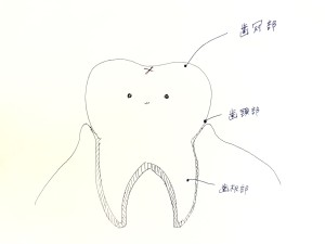 池袋　歯列矯正　歯根吸収