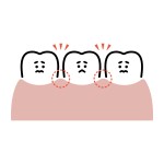池袋　ワイヤー矯正　すきっぱ