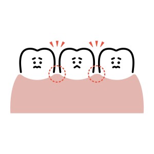池袋　ワイヤー矯正　すきっぱ