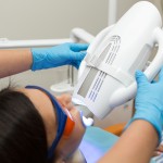 オフィスホワイトニング 矯正