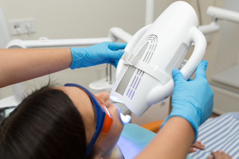 オフィスホワイトニング 矯正